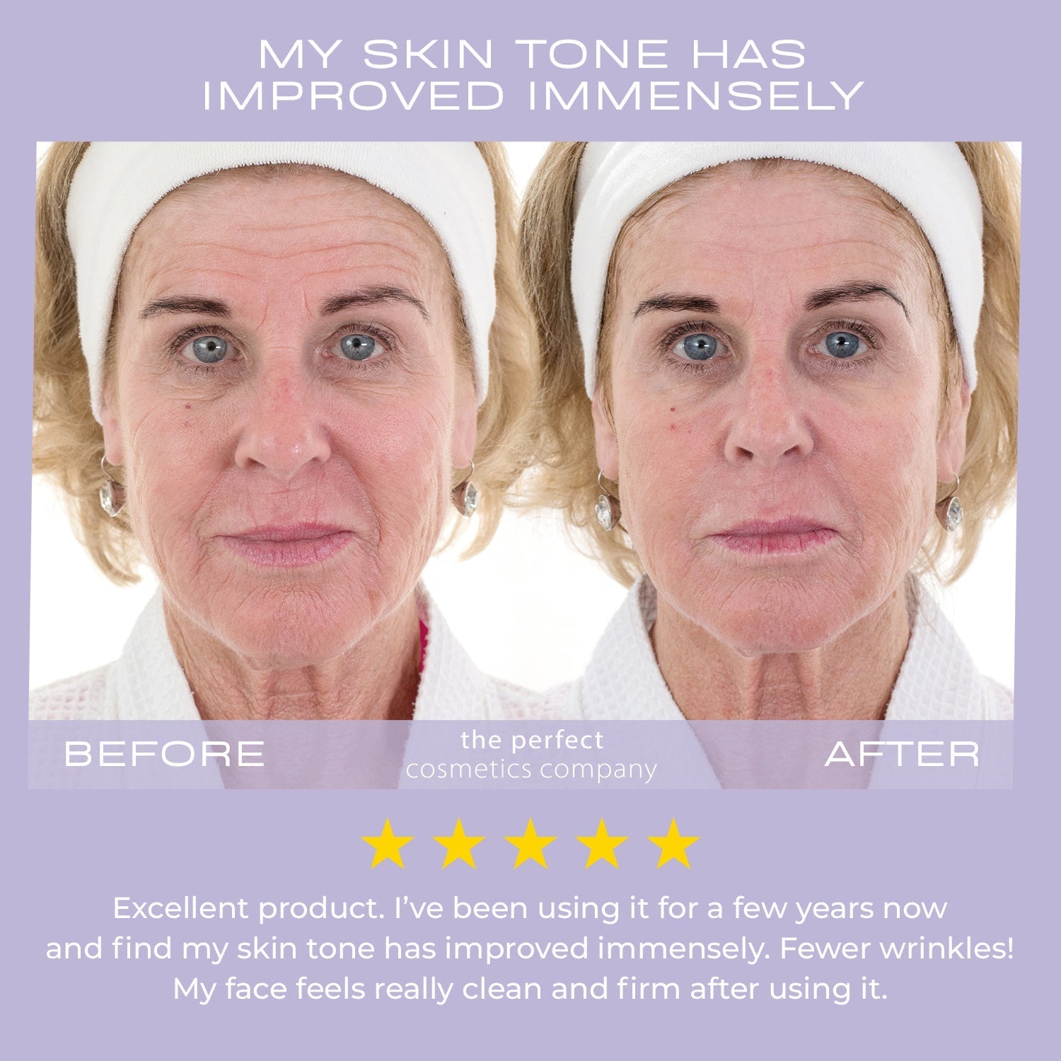 MY PERFECT RENEWAL KIT