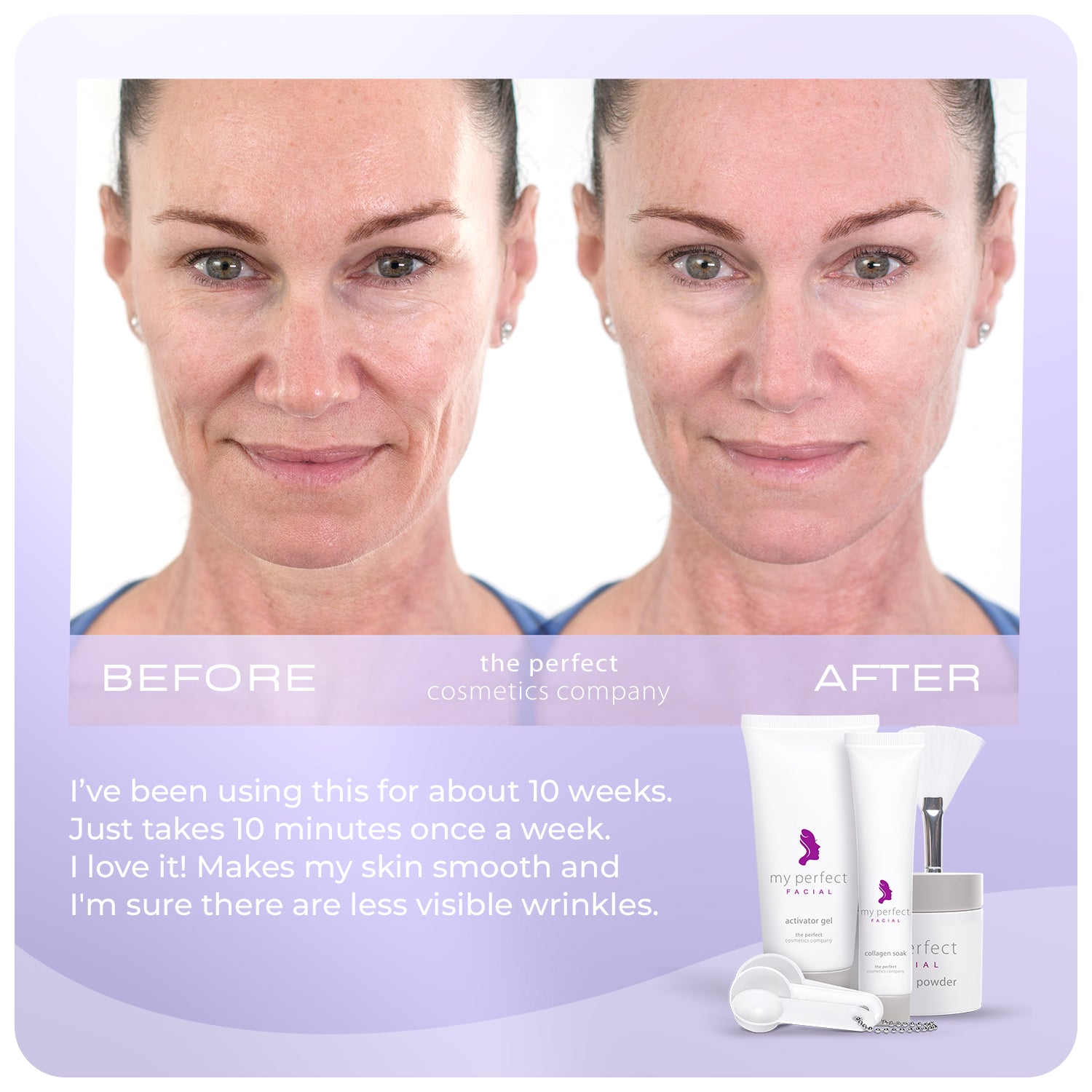 Before and after facial skin smoothing, fine lines and wrinkles, My Perfect Facial results, lifting and firming appearance