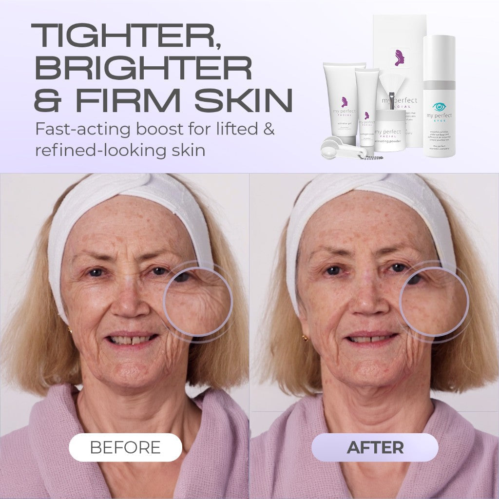 Lunchtime Facelift | Penny Lane's 30-Minute No-Downtime Face Lift